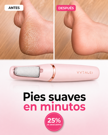 Removedor Eléctrico de Durezas | Pies Suaves en Minutos