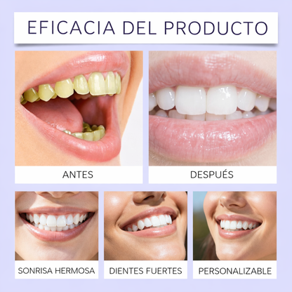 Tiras Blanqueadoras Dentales